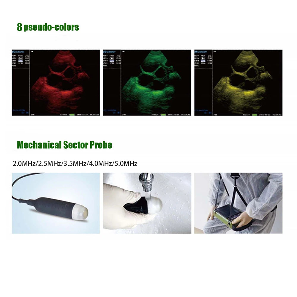 Dawei Veterinary Ultrasound Scanner with 3.5Mhz Convex Probe for Livestock